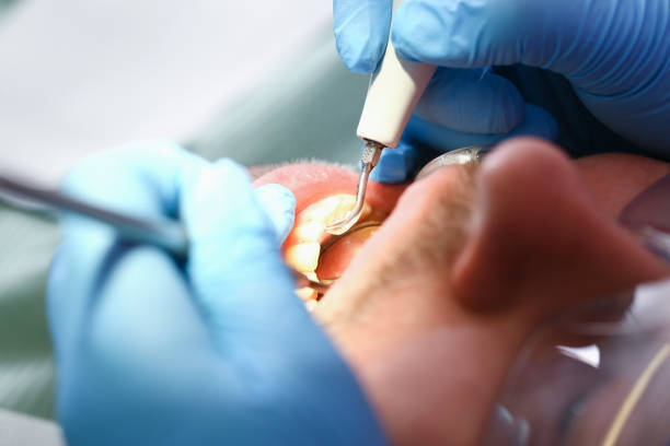 Best Emergency Treatment for Toothache in Benton, IL