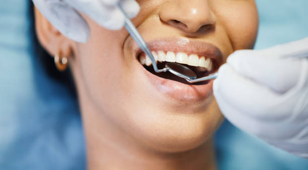Best Same-Day Emergency Dentist in Benton, IL