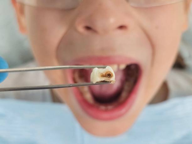 Best Emergency Treatment for Toothache in Benton, IL